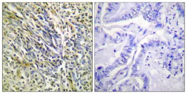 Anti-Aggrecan (cleaved Asp369) antibody used in IHC (Paraffin sections) (IHC-P). GTX86902
