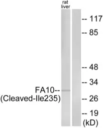 Anti-Factor X (cleaved Ile235) antibody used in Western Blot (WB). GTX86907