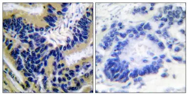 Anti-Caspase 3 (cleaved Asp175) antibody used in IHC (Paraffin sections) (IHC-P). GTX86909
