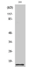 Anti-Caspase 7 (cleaved Asp198) antibody used in Western Blot (WB). GTX86925