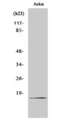 Anti-Factor VII (cleaved Arg212) antibody used in Western Blot (WB). GTX86939