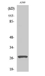 Anti-Cathepsin D (cleaved Leu169) antibody used in Western Blot (WB). GTX86942