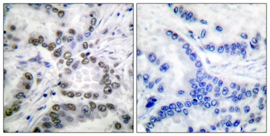 Anti-CBP (acetyl Lys1535) antibody used in IHC (Paraffin sections) (IHC-P). GTX86958