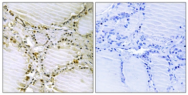 Anti-AMPD1 antibody used in IHC (Paraffin sections) (IHC-P). GTX86973