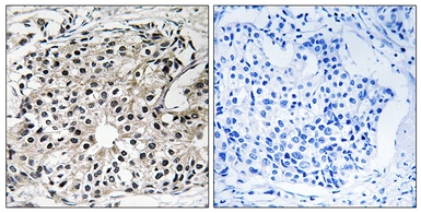 Anti-PECI antibody used in IHC (Paraffin sections) (IHC-P). GTX87000