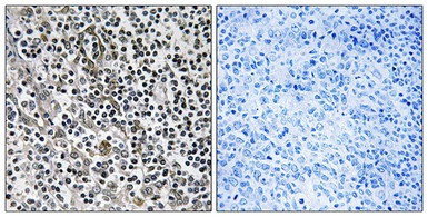 Anti-MRPL51 antibody used in IHC (Paraffin sections) (IHC-P). GTX87035