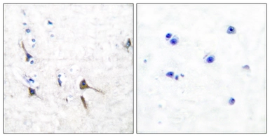 Anti-Potassium Channel Kv3.2b antibody used in IHC (Paraffin sections) (IHC-P). GTX87037