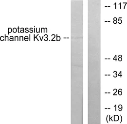 Anti-Potassium Channel Kv3.2b antibody used in Western Blot (WB). GTX87037