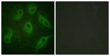 Anti-MAP4 antibody used in Immunocytochemistry/ Immunofluorescence (ICC/IF). GTX87039
