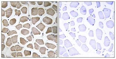 Anti-MCT12 antibody used in IHC (Paraffin sections) (IHC-P). GTX87072