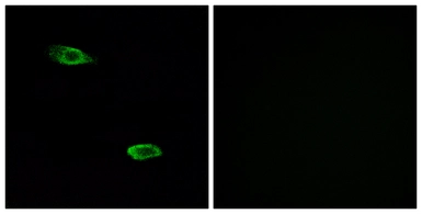 Anti-OR51E2 antibody used in Immunocytochemistry/ Immunofluorescence (ICC/IF). GTX87083