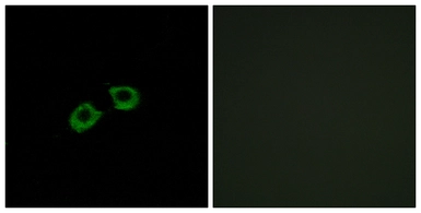 Anti-ARFGEF2 antibody used in Immunocytochemistry/ Immunofluorescence (ICC/IF). GTX87126