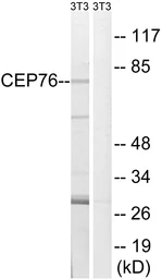 Anti-CEP76 antibody used in Western Blot (WB). GTX87193