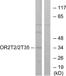 Anti-OR2T2 + OR2T35 antibody used in Western Blot (WB). GTX87219