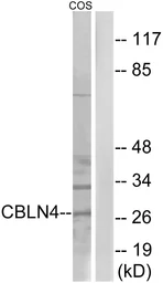Anti-CBLN4 antibody used in Western Blot (WB). GTX87225