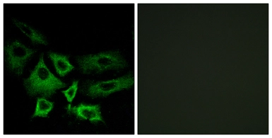 Anti-NT5C1A antibody used in Immunocytochemistry/ Immunofluorescence (ICC/IF). GTX87233