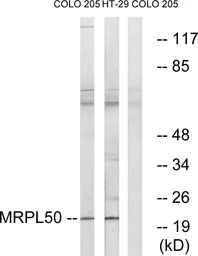 Anti-MRPL50 antibody used in Western Blot (WB). GTX87263