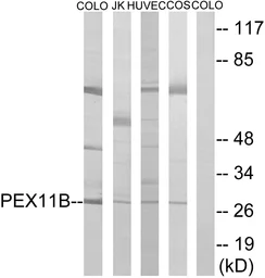 Anti-PEX11B antibody used in Western Blot (WB). GTX87266