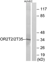 Anti-OR2T2 + OR2T35 antibody used in Western Blot (WB). GTX87270