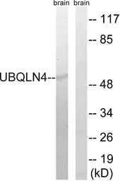Anti-Ubiquilin 4 antibody used in Western Blot (WB). GTX87325