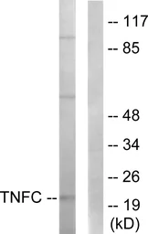 Anti-Lymphotoxin beta antibody used in Western Blot (WB). GTX87332