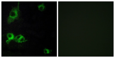 Anti-LAMA1 antibody used in Immunocytochemistry/ Immunofluorescence (ICC/IF). GTX87333