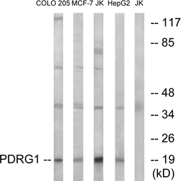 Anti-PDRG1 antibody used in Western Blot (WB). GTX87374