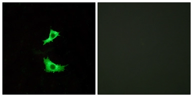 Anti-FFAR3 antibody used in Immunocytochemistry/ Immunofluorescence (ICC/IF). GTX87383