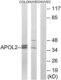Anti-Apolipoprotein L2 antibody used in Western Blot (WB). GTX87407