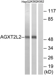 Anti-AGXT2L2 antibody used in Western Blot (WB). GTX87423