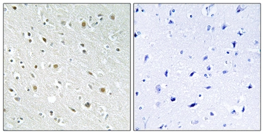 Anti-SSBP2 antibody used in IHC (Paraffin sections) (IHC-P). GTX87442