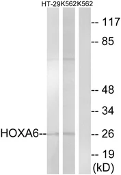 Anti-HOXA6 antibody used in Western Blot (WB). GTX87454