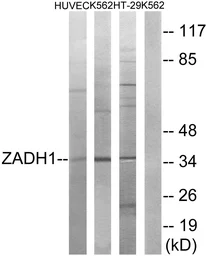 Anti-ZADH1 antibody used in Western Blot (WB). GTX87478
