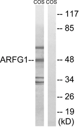 Anti-ARFGAP1 antibody used in Western Blot (WB). GTX87479