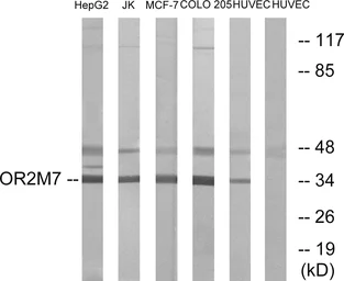Anti-OR2M7 antibody used in Western Blot (WB). GTX87482