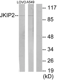 Anti-JAKMIP2 antibody used in Western Blot (WB). GTX87490