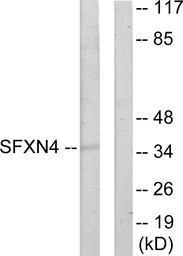 Anti-SFXN4 antibody used in Western Blot (WB). GTX87501