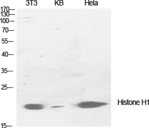 Anti-Histone H1 antibody used in Western Blot (WB). GTX87506