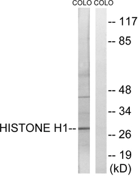 Anti-Histone H1 antibody used in Western Blot (WB). GTX87506
