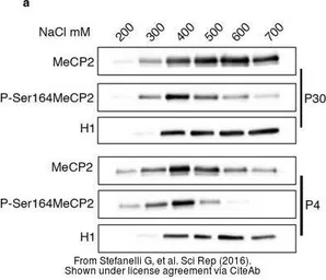 Anti-Histone H1 antibody used in Western Blot (WB). GTX87506