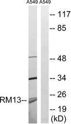 Anti-MRPL13 antibody used in Western Blot (WB). GTX87614