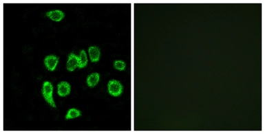 Anti-MRPL32 antibody used in Immunocytochemistry/ Immunofluorescence (ICC/IF). GTX87619