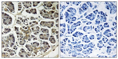 Anti-ATP5G2 antibody used in IHC (Paraffin sections) (IHC-P). GTX87662