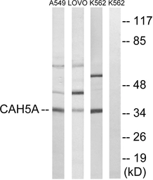 Anti-CA5A antibody used in Western Blot (WB). GTX87702