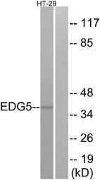 Anti-S1PR2 antibody used in Western Blot (WB). GTX87713