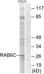 Anti-RAB6C antibody used in Western Blot (WB). GTX87758