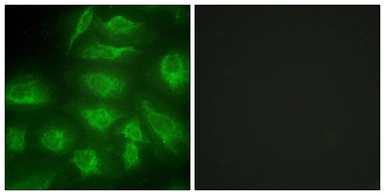 Anti-DGKI antibody used in Immunocytochemistry/ Immunofluorescence (ICC/IF). GTX87789
