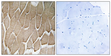 Anti-RAB34 antibody used in IHC (Paraffin sections) (IHC-P). GTX87791