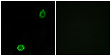 Anti-ABCA13 antibody used in Immunocytochemistry/ Immunofluorescence (ICC/IF). GTX87815