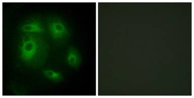 Anti-DLEC1 antibody used in Immunocytochemistry/ Immunofluorescence (ICC/IF). GTX87820